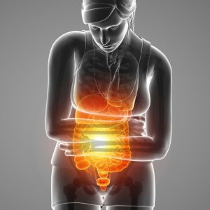 Is a diverticula disease characterized for small pouches inthe lining of the intestines.